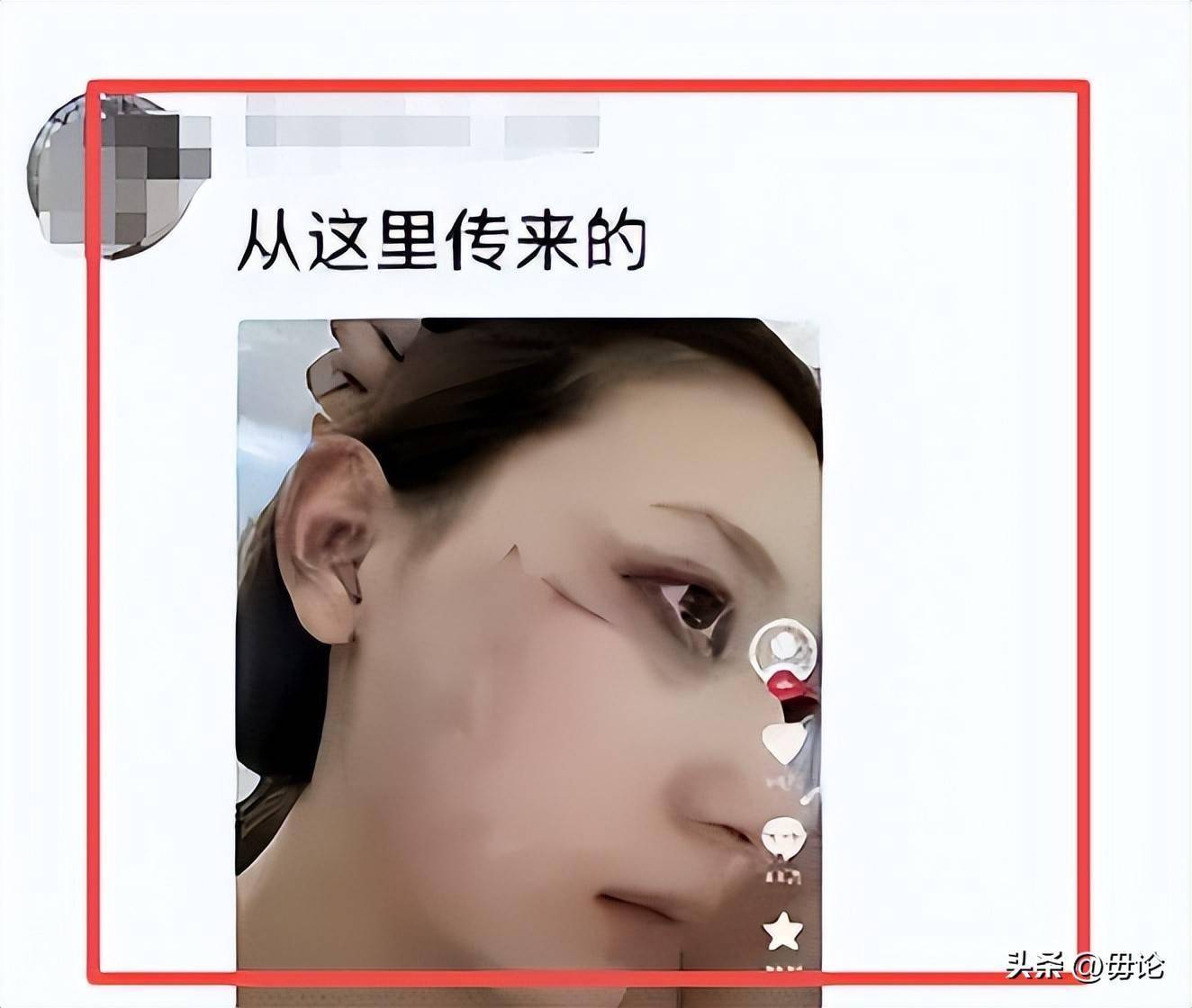 张百乔小雪卖别墅 近零互动疑婚变
